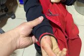 KUMRU’DA İLKOKUL ÖĞRENCİSİNE KÖPEK SALDIRDI
