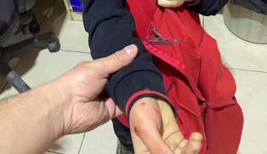 KUMRU’DA İLKOKUL ÖĞRENCİSİNE KÖPEK SALDIRDI