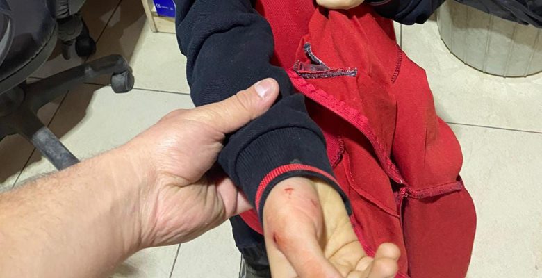 KUMRU’DA İLKOKUL ÖĞRENCİSİNE KÖPEK SALDIRDI