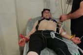 FINDIK BAHÇESİNDE ÇALIŞIRKEN YILAN SOKTU